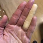 These are the consequences of sleeping with the…