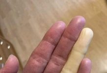 These are the consequences of sleeping with the…