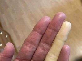 These are the consequences of sleeping with the…