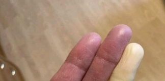 These are the consequences of sleeping with the…