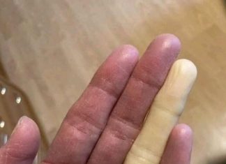 These are the consequences of sleeping with the…