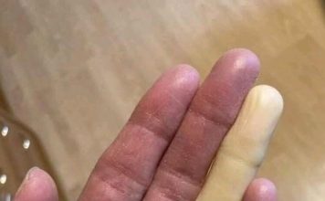 These are the consequences of sleeping with the…
