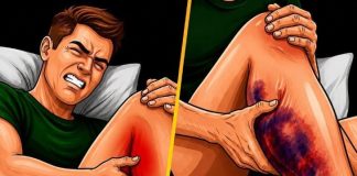If You Get Leg Cramps at Night, You Need to Know This Immediately