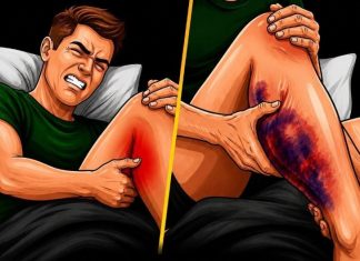 If You Get Leg Cramps at Night, You Need to Know This Immediately