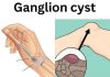 Healing Power And Important Safety Tips Of Castor Leaves