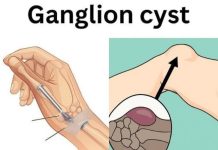 Healing Power And Important Safety Tips Of Castor Leaves