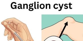 Healing Power And Important Safety Tips Of Castor Leaves