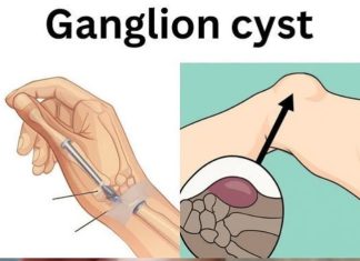 Healing Power And Important Safety Tips Of Castor Leaves