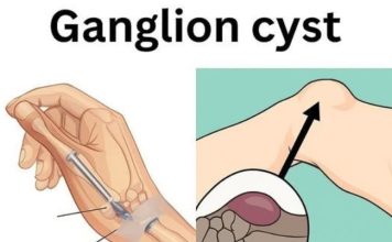 Healing Power And Important Safety Tips Of Castor Leaves