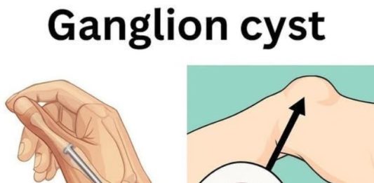 Healing Power And Important Safety Tips Of Castor Leaves