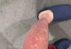 Here Are the Consequences of Sleeping with Wet Socks