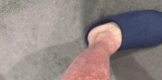 Here Are the Consequences of Sleeping with Wet Socks