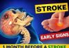 8 Warning Signs of Stroke That May Appear One Month Before — and 9 Ways to Help Reduce Your Risk
