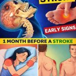 8 Warning Signs of Stroke That May Appear One Month Before — and 9 Ways to Help Reduce Your Risk