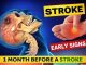 8 Warning Signs of Stroke That May Appear One Month Before — and 9 Ways to Help Reduce Your Risk