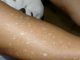 Have You Noticed Small White Spots on Your Arms or Legs? Here’s What They Are