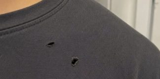 What’s Making Holes in Your Clothes? Causes and Easy Ways I Prevent Them