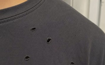 What’s Making Holes in Your Clothes? Causes and Easy Ways I Prevent Them