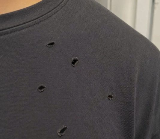 What’s Making Holes in Your Clothes? Causes and Easy Ways I Prevent Them