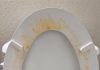 That Gross Yellow Ring? Here’s How I Actually Got Rid of Toilet Stains