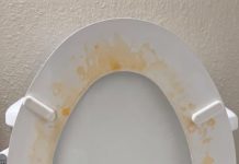That Gross Yellow Ring? Here’s How I Actually Got Rid of Toilet Stains
