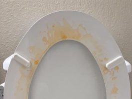 That Gross Yellow Ring? Here’s How I Actually Got Rid of Toilet Stains