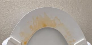 That Gross Yellow Ring? Here’s How I Actually Got Rid of Toilet Stains