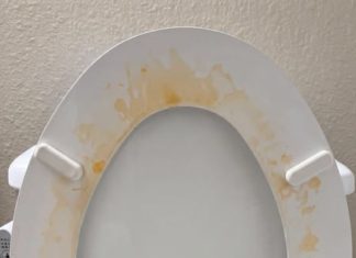 That Gross Yellow Ring? Here’s How I Actually Got Rid of Toilet Stains