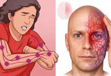 A month before a stroke, your body warns you: 10 signs not to ignore