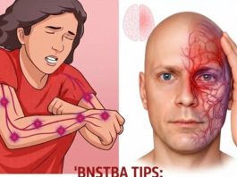 A month before a stroke, your body warns you: 10 signs not to ignore