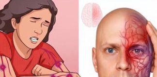 A month before a stroke, your body warns you: 10 signs not to ignore