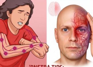 A month before a stroke, your body warns you: 10 signs not to ignore