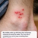 My toddler woke up with these tiny red bumps clustered all around his ankles. The nurse line is completely busy and he keeps scratching them. What is this?