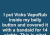 I put Vicks VapoRub inside my belly button and covered it with a bandaid for 14 nights. This is what happened
