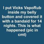 I put Vicks VapoRub inside my belly button and covered it with a bandaid for 14 nights. This is what happened