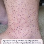 My husband woke up with these tiny flat purple dots spreading all over his lower legs and ankles. We are hours from urgent care. Is this serious?