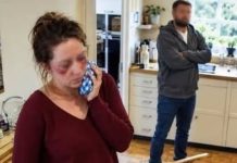 During breakfast, my husband threw boiling coffee in my face because I refused to hand my credit card to his sister 666
