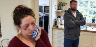 During breakfast, my husband threw boiling coffee in my face because I refused to hand my credit card to his sister 666