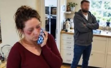 During breakfast, my husband threw boiling coffee in my face because I refused to hand my credit card to his sister 666