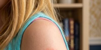 My Daughter Woke Up With a Strange Red Ring on Her Arm: A Parent’s Guide to Ring-Shaped Rashes (And When to Breathe Easy)