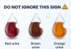 What does the color of your urine say about your health?
