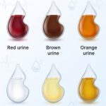 What does the color of your urine say about your health?