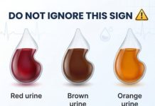 What does the color of your urine say about your health?