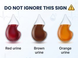 What does the color of your urine say about your health?