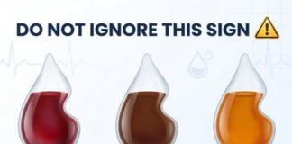 What does the color of your urine say about your health?