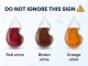 What does the color of your urine say about your health?