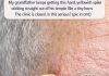 My grandfather keeps getting this hard, yellowish spike sticking straight out of his temple like a tiny horn. The clinic is closed. Is this serious?