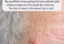 My grandfather keeps getting this hard, yellowish spike sticking straight out of his temple like a tiny horn. The clinic is closed. Is this serious?
