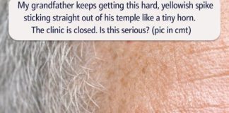 My grandfather keeps getting this hard, yellowish spike sticking straight out of his temple like a tiny horn. The clinic is closed. Is this serious?